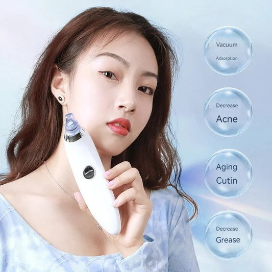 Emart™ USB Rechargeable  Blackhead Remover – Suction Pore Cleaner & Facial Beauty Tool